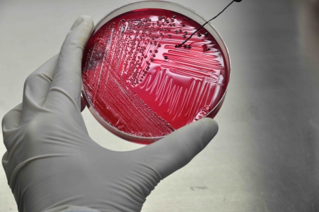 Trabalho premiado verificou resistência antimicrobiana das Salmonelas presentes na alimentação das aves