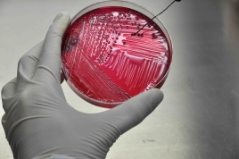 Trabalho premiado verificou resistência antimicrobiana das Salmonelas presentes na alimentação das aves